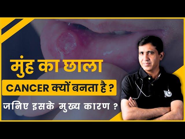 Mouth Ulcer कहीं मुंह के छाले कैंसर का रूप तो नहीं ले रहें ?