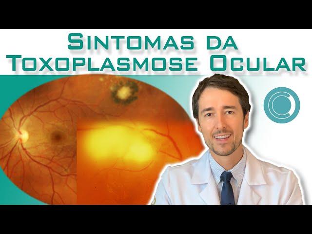 Sintomas da Toxoplasmose Ocular