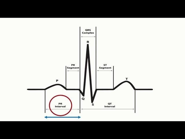 Corrected QT interval (QTc) calculation with Bazett's formula