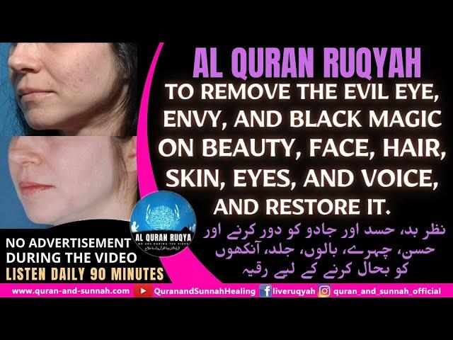 AL QURAN RUQYAH TO REMOVE THE EVIL EYE, ENVY & MAGIC ON BEAUTY, FACE, HAIR, SKIN, EYES & RESTORE IT.