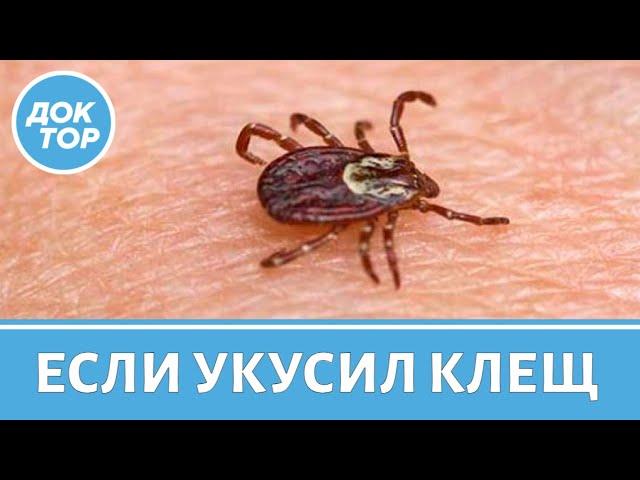 Что делать, если укусил клещ? Первая помощь