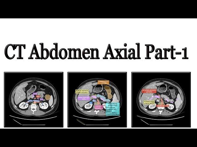 CT Scan of abdomen part 1