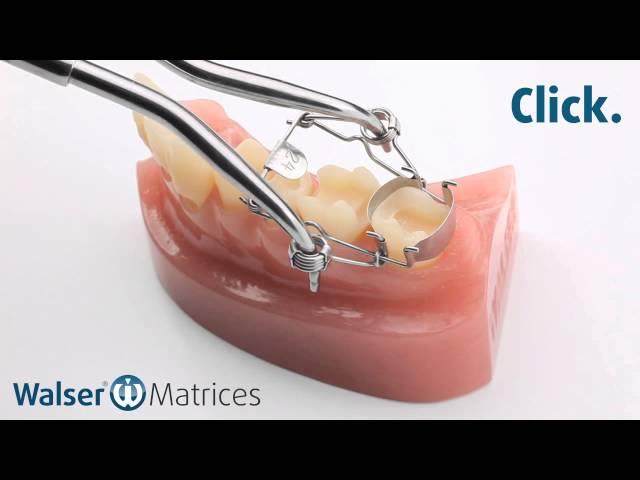 Walser® Sectional Matrix system: Application ON-form dental matrix