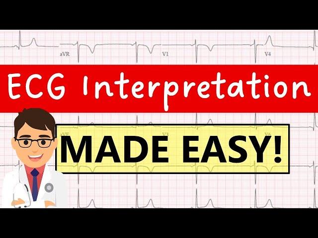 How to interpret an ECG systematically | EXPLAINED CLEARLY!