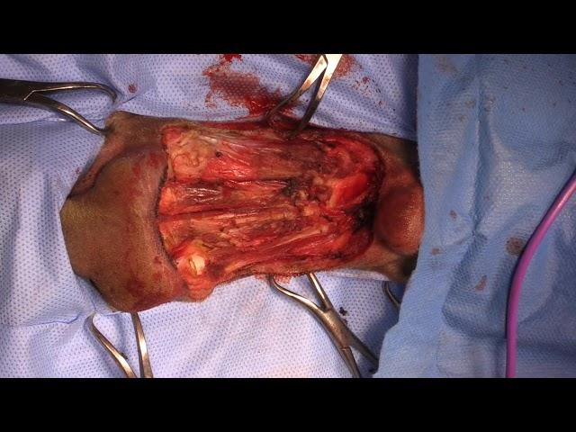 wide excision paw mass including flexor tendons