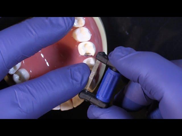 FitStrip Subgingival Finishing Strips from Garrison Dental Solutions