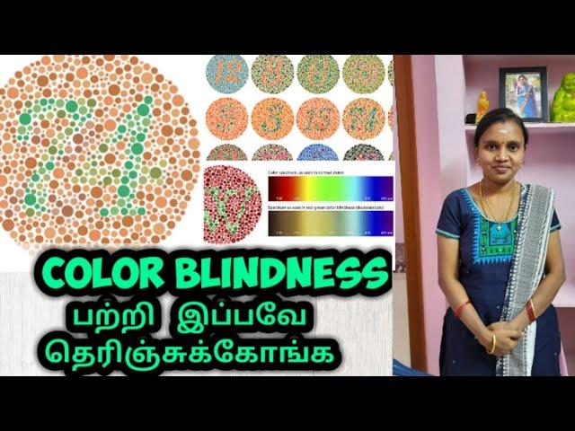 Color Blindness Problem In Tamil|| 3RosesLifeStyle