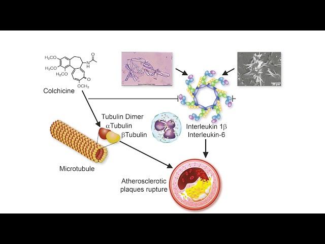 Colchicine