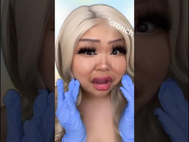 ASMR Botox Gone WRONG ‼️‼️ #asmr #tingly