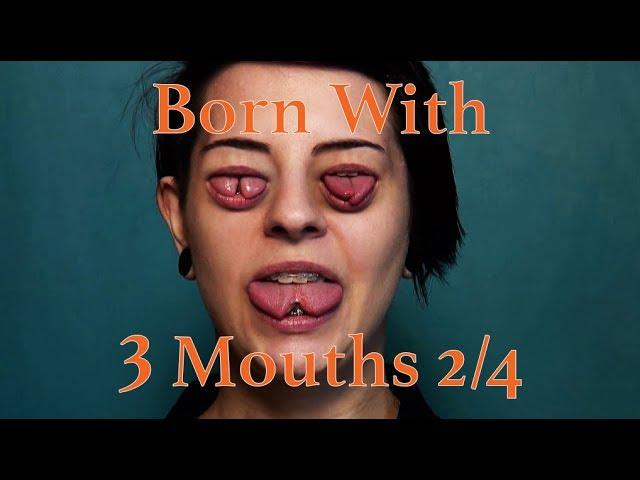 Born With Three Mouths 2/4 - Girl With Split Tongue