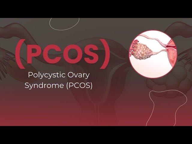 PCOS awareness