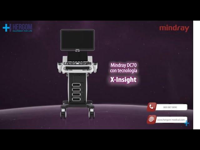 Mindray DC70 con X-Insight