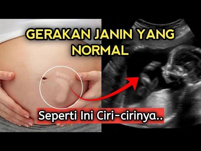 SEPERTI APA GERAKAN JANIN YANG NORMAL? BUMIL PERHATIKAN INI..