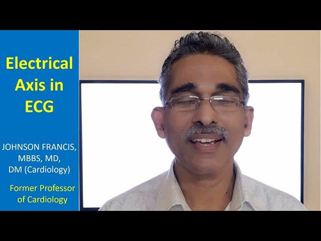 Determination of Electrical Axis in ECG