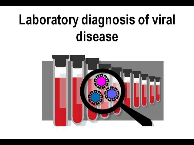 Laboratory diagnosis of viral disease