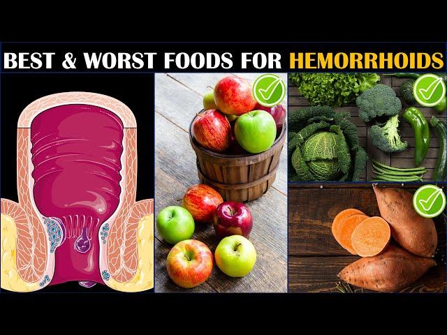 Hemorrhoids? Best & Worst Foods For Hemorrhoids |What To Eat & What To Avoid If You Have Hemorrhoids