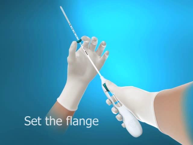 Animation for insertion of Mirena IUD