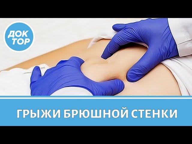 Лечение грыж передней брюшной стенки