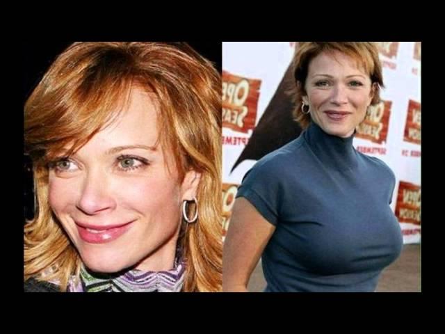 Lauren Holly Looking Younger After Plastic Surgery