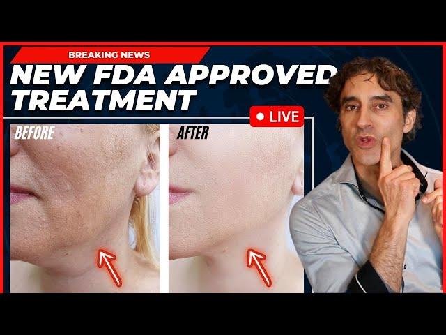 REMOVE JOWLS & TIGHTEN YOUR FACE WITHOUT SURGERY -Everything You Need To Know NEW Approved Procedure