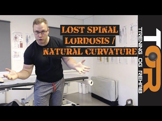 Lost spinal or flattened spinal lordosis / natural curvature and how to re obtain it