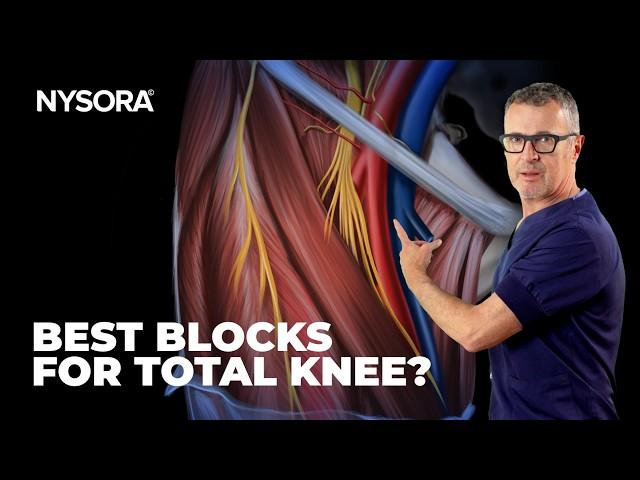 Optimal Analgesia for Total Knee