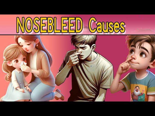 Nosebleeds - Top 7  Causes: When to Worry?!