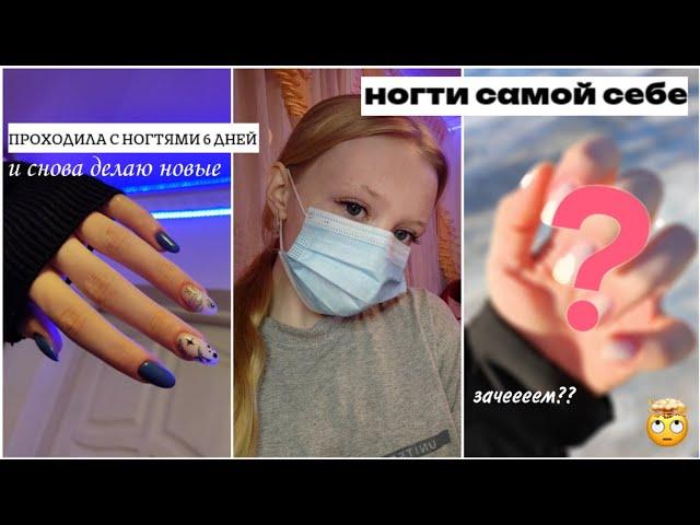 ноготочки себе спустя 6 дней*шок*