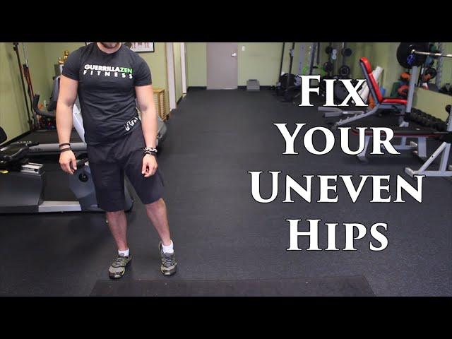 How To Fix Uneven Hips | Lateral Pelvic Tilt OR Leg Length Discrepancy?