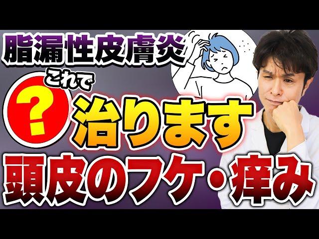 頭のフケやかゆみ、それは病気のサイン？！脂漏性皮膚炎の原因と効果的な治療法