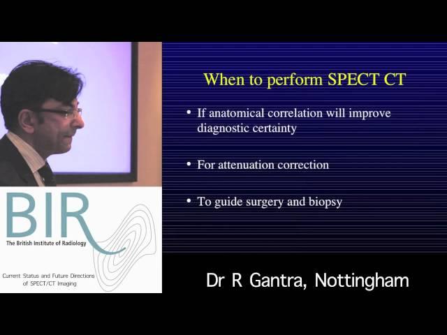 Current Status and Future Directions of SPECT/CT Imaging: Image Fusion and Clinical Utility