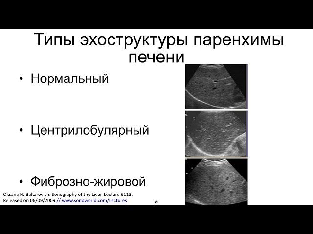 Классификация диффузных изменений печени