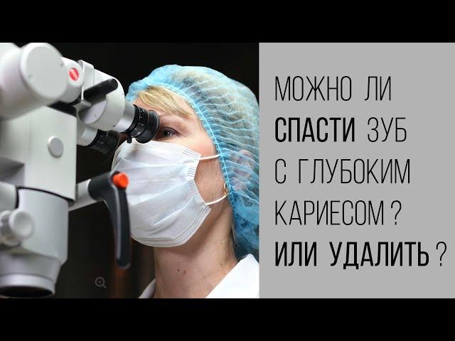 Можно ли спасти зуб с глубоким кариесом?