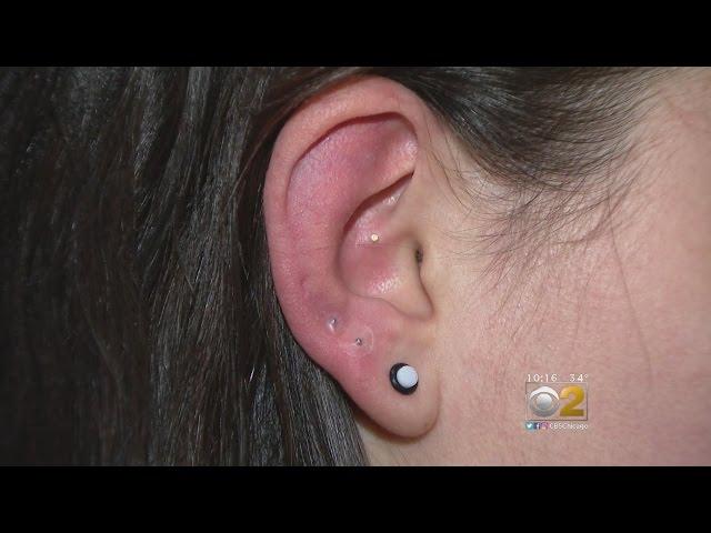 Alternative Healing Therapy: 'Ear Seeds'