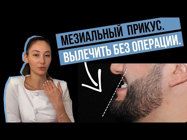 Мезиальный прикус. Как исправить без операции?