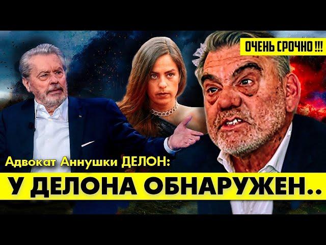 Страшное заявление адвоката Анушки ДЕЛОН просто взорвало сеть!  #аленделон #делон