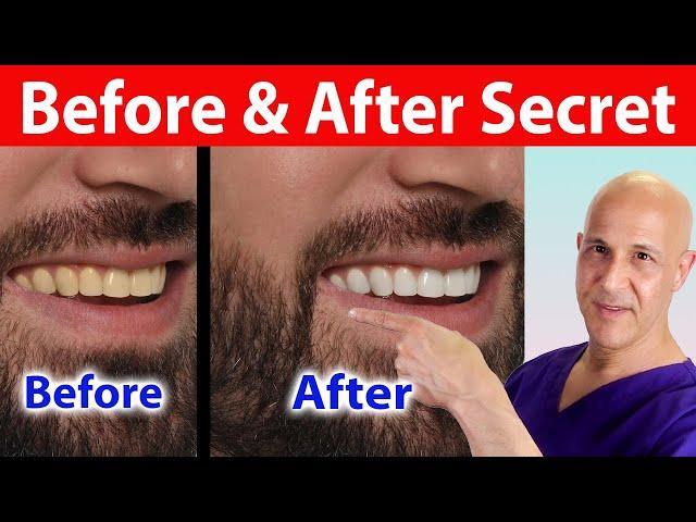 This Secret Fruit Whitens Teeth Instantly—You’ll Be Amazed!  Dr. Mandell