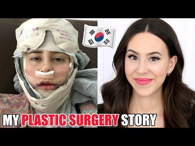 I GOT PLASTIC SURGERY IN KOREA || Double Jaw Surgery Experience