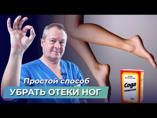 Избавьтесь от ОТЕКОВ ног с помощью 1 процедуры! Отекают ноги: что делать? Отёки на ногах лечение