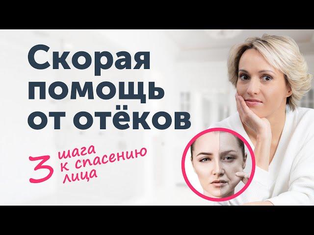 Откуда ОТЁКИ? 3 шага к спасению лица.