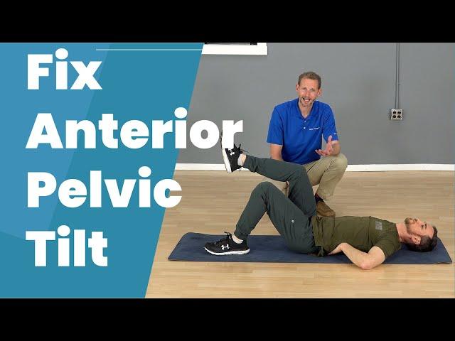 Anterior Pelvic Tilt Correction Exercises