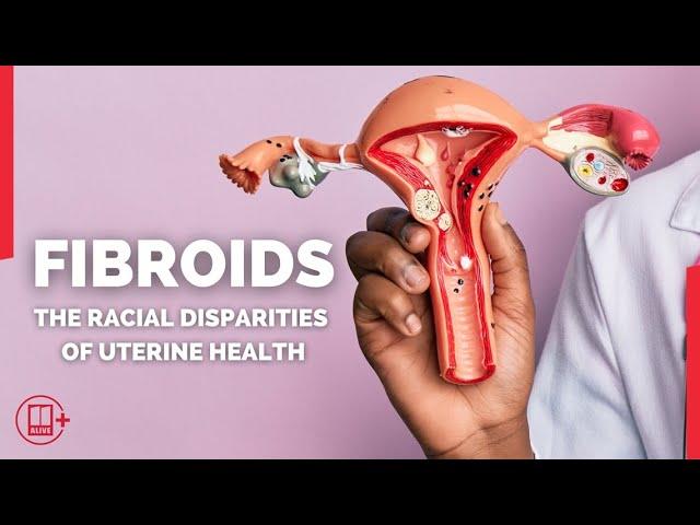 Black women and fibroids: The racial disparities of uterine health