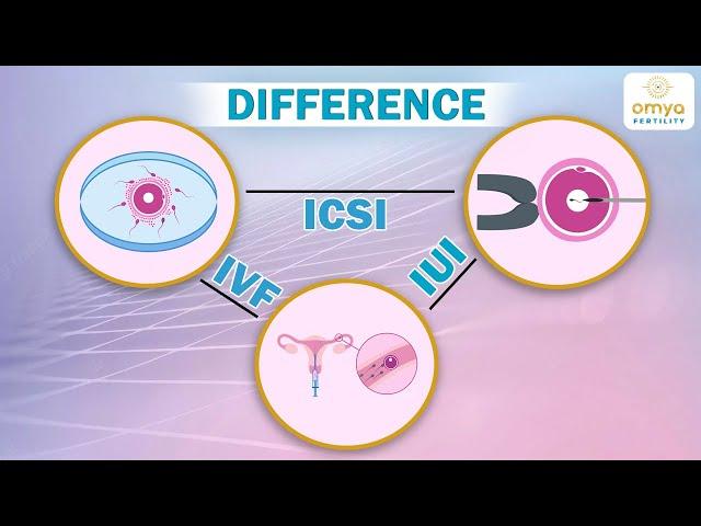  IUI, IVF & ICSI क्या है? Difference between #IUI #IVF & #ICSI |   ICSI, IUI And IVF Pros and Cons