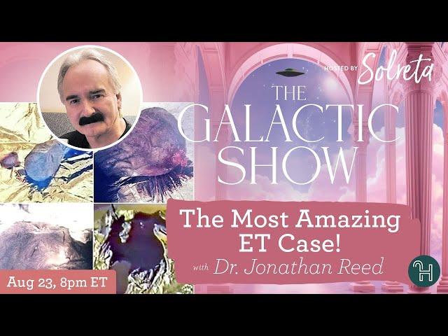 THE MOST AMAZING ET CASE! with Dr. Jonathan Reed  The Galactic Show hosted by Solreta