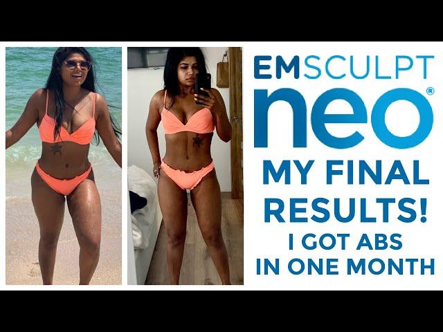 EMSCULPT NEO RESULTS! I did 5 sessions over 5 weeks!