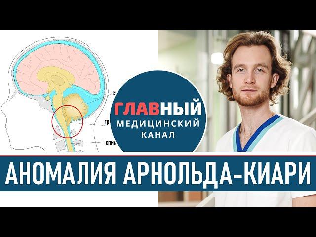 Симптомы Аномалии Арнольда-Киари. Синдром Арнольда Киари 1-2 типа/степени. Эктопия миндалин мозжечка