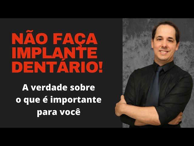 VOCÊ NÃO PRECISA FAZER IMPLANTE DENTÁRIO! ENTENDA O QUE REALMENTE É IMPORTANTE PARA SUA SAÚDE.