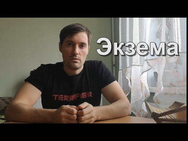 ЭКЗЕМА. Откуда она у меня. Как я её вылечил.