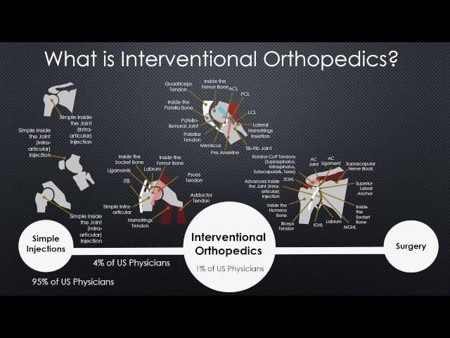 What is Interventional Orthopedics?