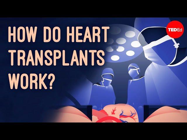 How does heart transplant surgery work? - Roni Shanoada